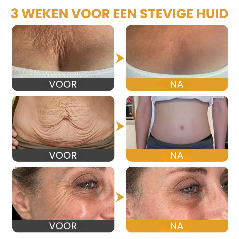 VenoFirm™ | Botox Rimpelverstevigende Crème