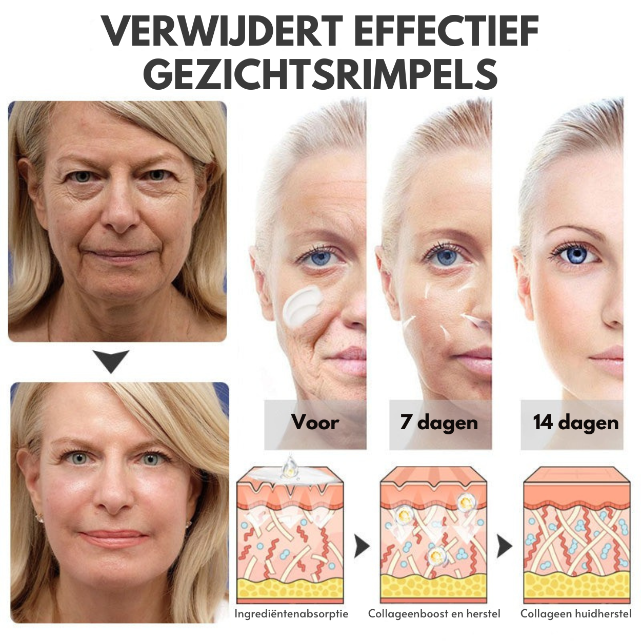 NuveaSkin™ | Rimpelverwijderende Crème
