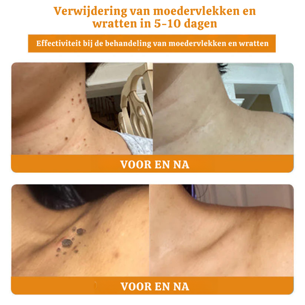 HIVECURA™ | Huidverzorgingsessence