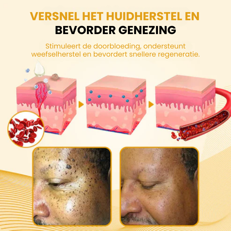 DERMCLYR™ | Antibacteriële Huidherstelgel