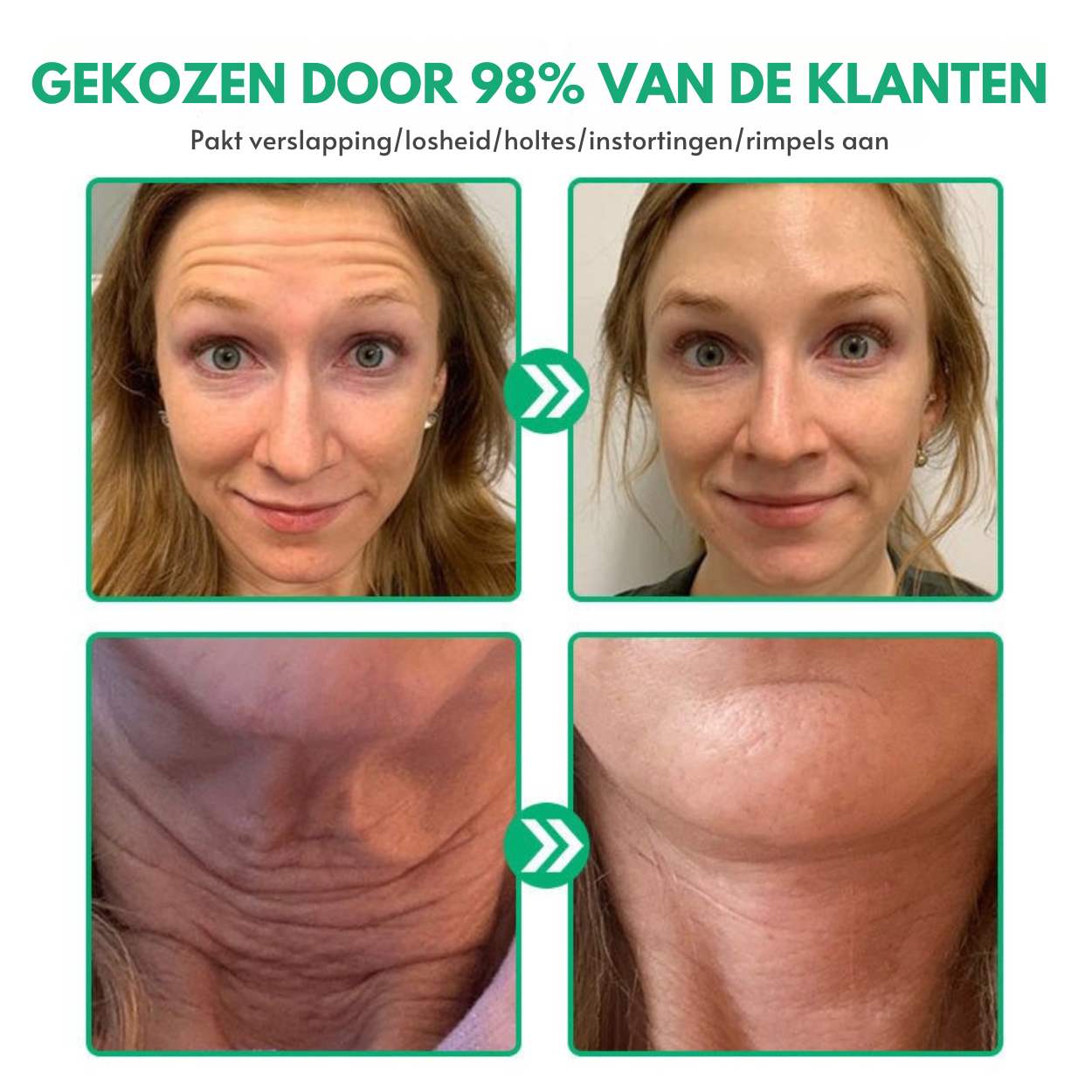 NuveaSkin™ | Rimpelverwijderende Crème