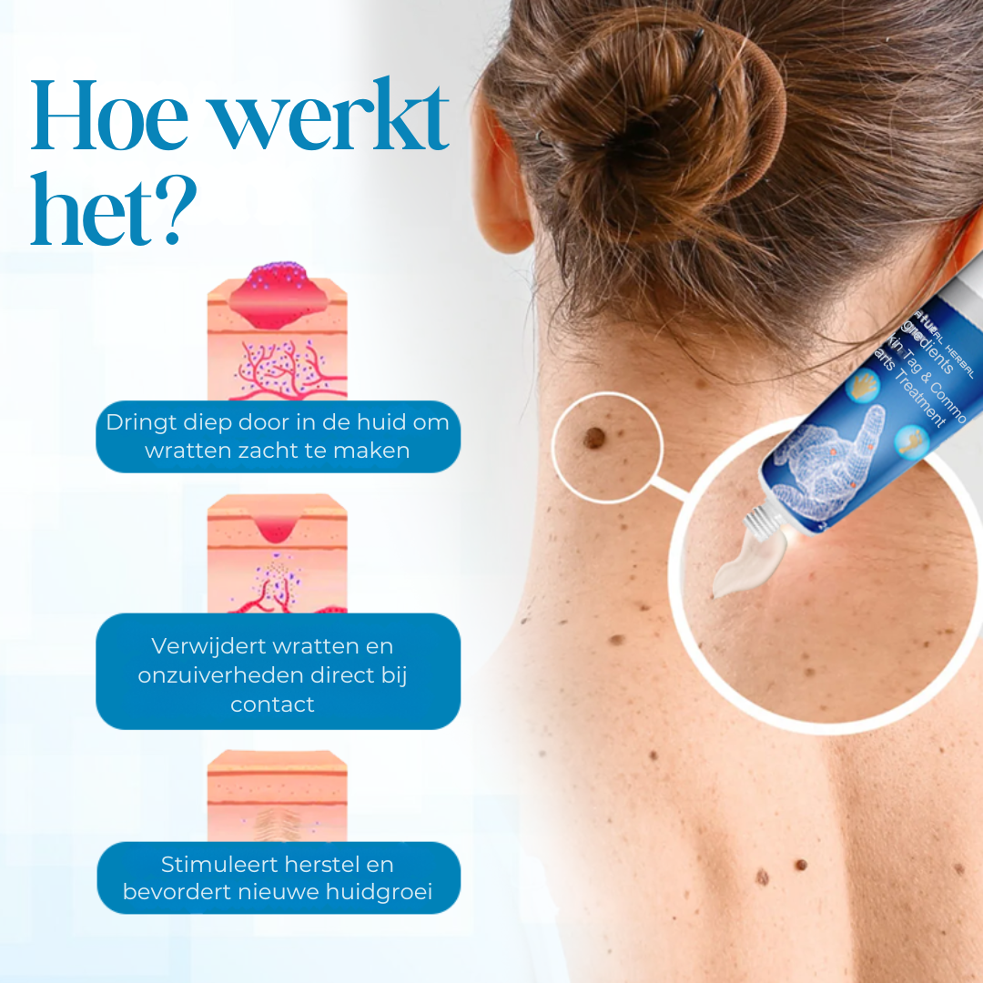 PapiClear™ | Huidtag & Wratten Crème