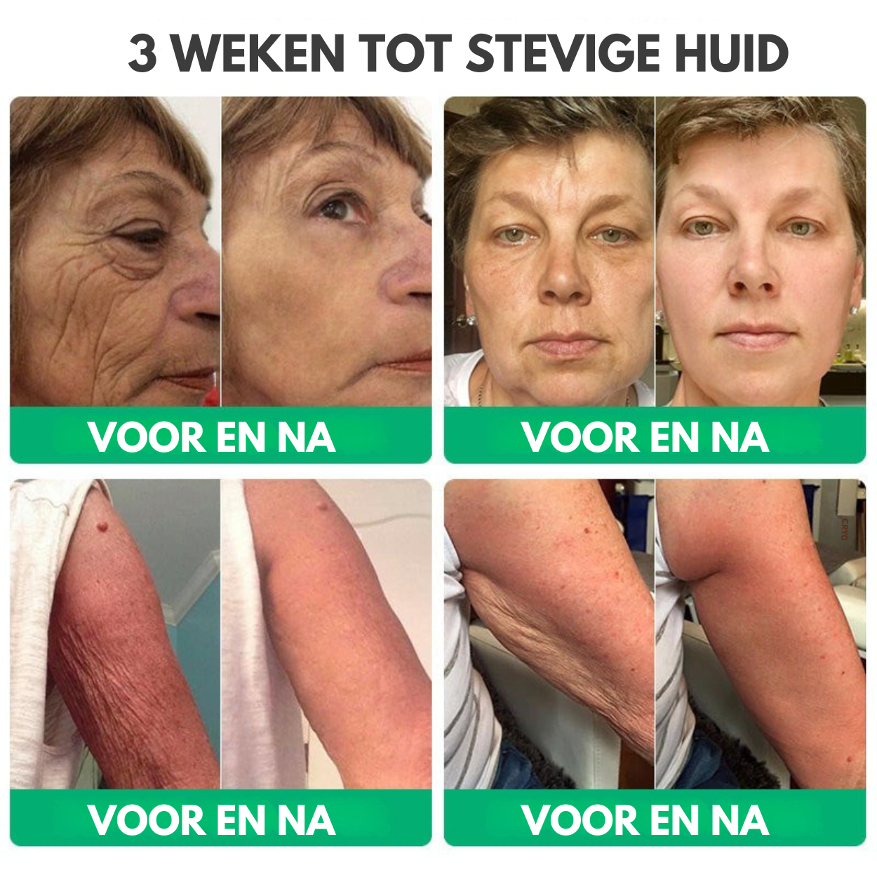 NuveaSkin™ | Rimpelverwijderende Crème