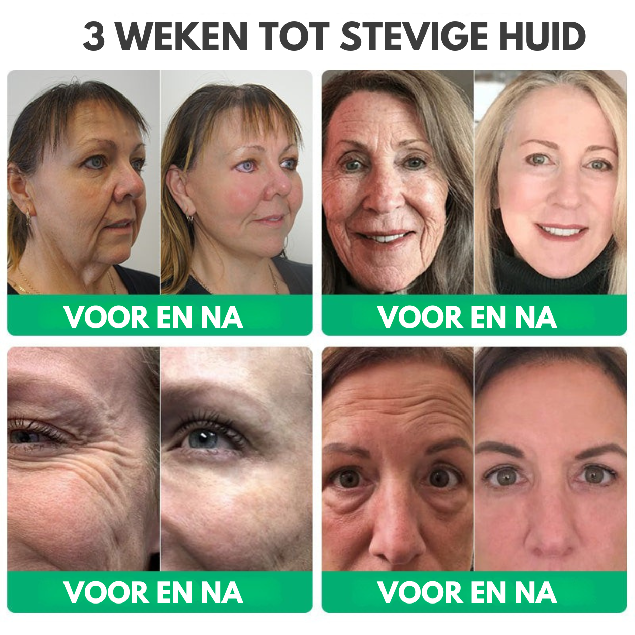 NuveaSkin™ | Rimpelverwijderende Crème