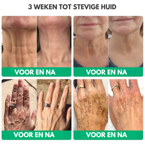 NuveaSkin™ | Rimpelverwijderende Crème