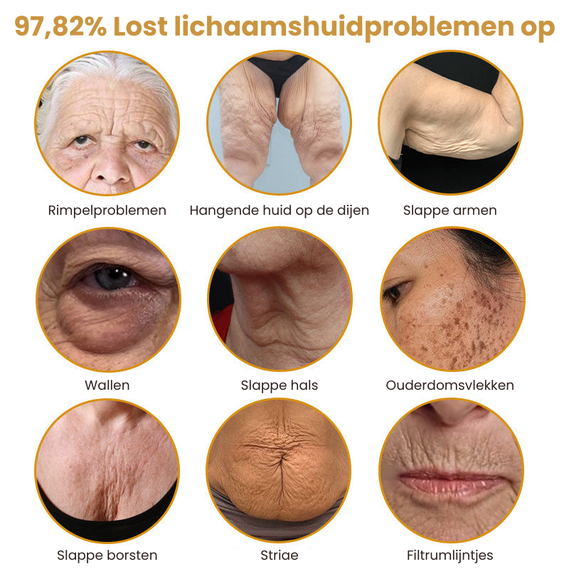 VenoFirm™ | Botox Rimpelverstevigende Crème