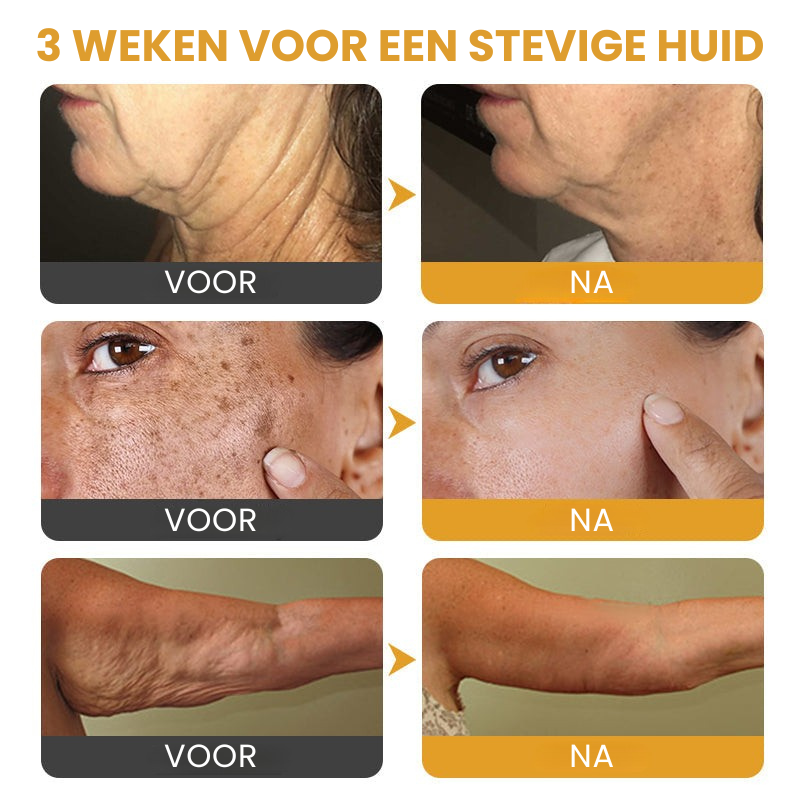 VenoFirm™ | Botox Rimpelverstevigende Crème