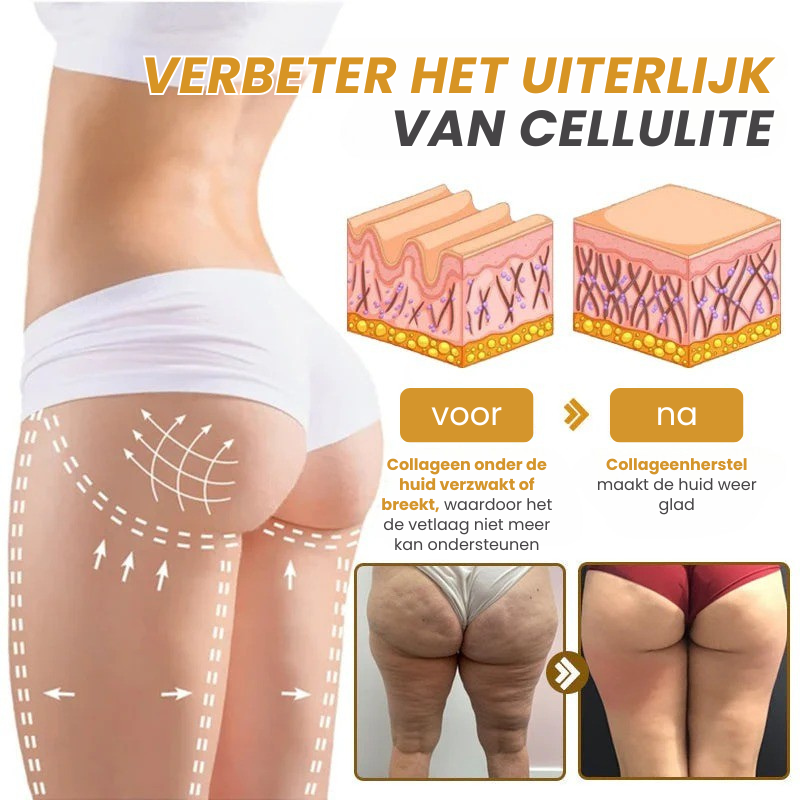 VenoFirm™ | Botox Rimpelverstevigende Crème