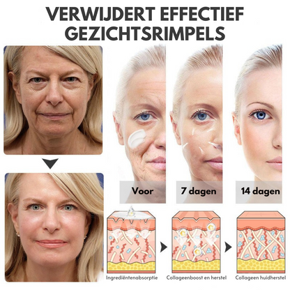 NuveaSkin™ | Rimpelverwijderende Crème