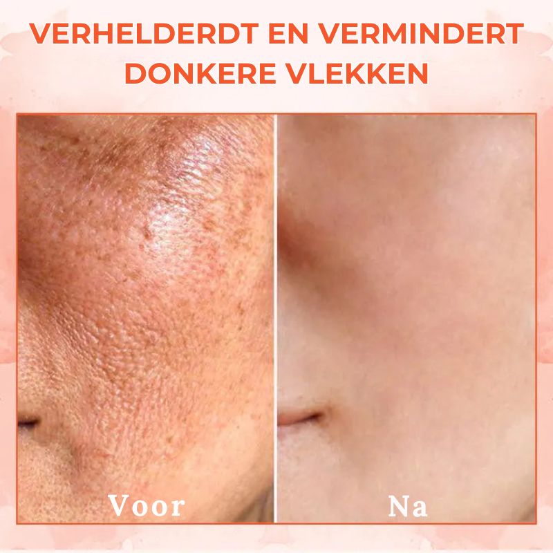 TONESKA™ | Verstevigende Lichaamscrème