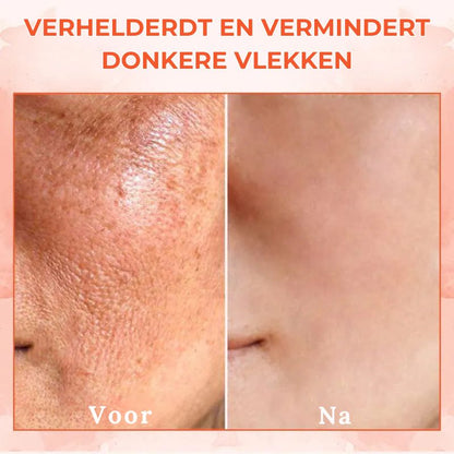 TONESKA™ | Verstevigende Lichaamscrème