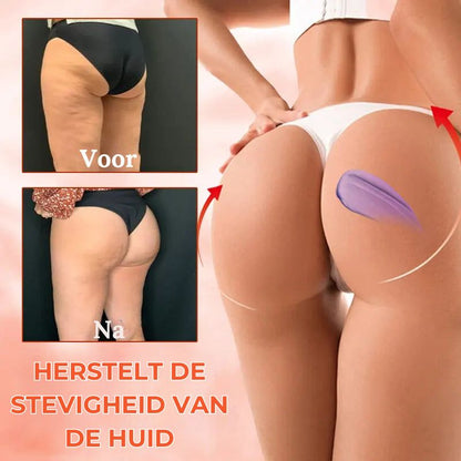 TONESKA™ | Verstevigende Lichaamscrème