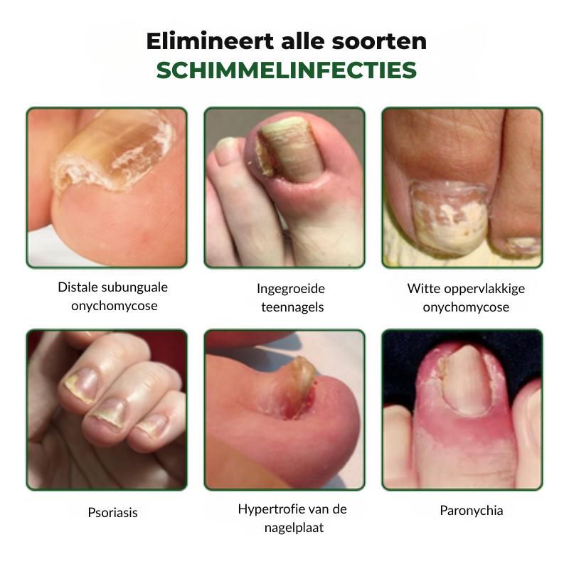 SCHIMIFYX™ | Schimmelbehandelolie