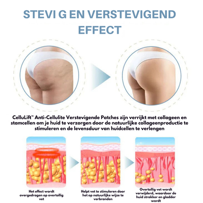 FirmiSkin™ | Anti-Cellulite Verstevigende Patches