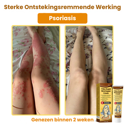 ZestyRenew™ | Huidherstelcrème