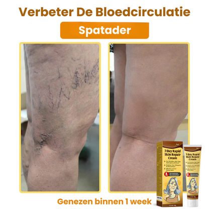 ZestyRenew™ | Huidherstelcrème