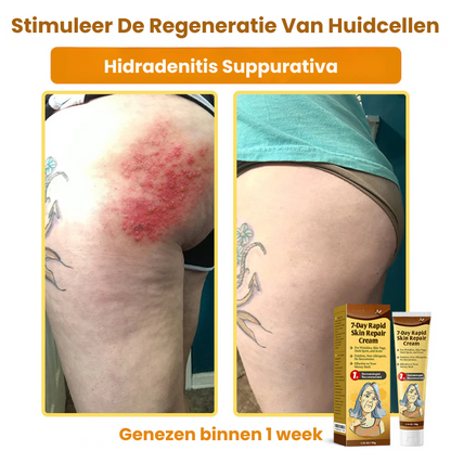 ZestyRenew™ | Huidherstelcrème