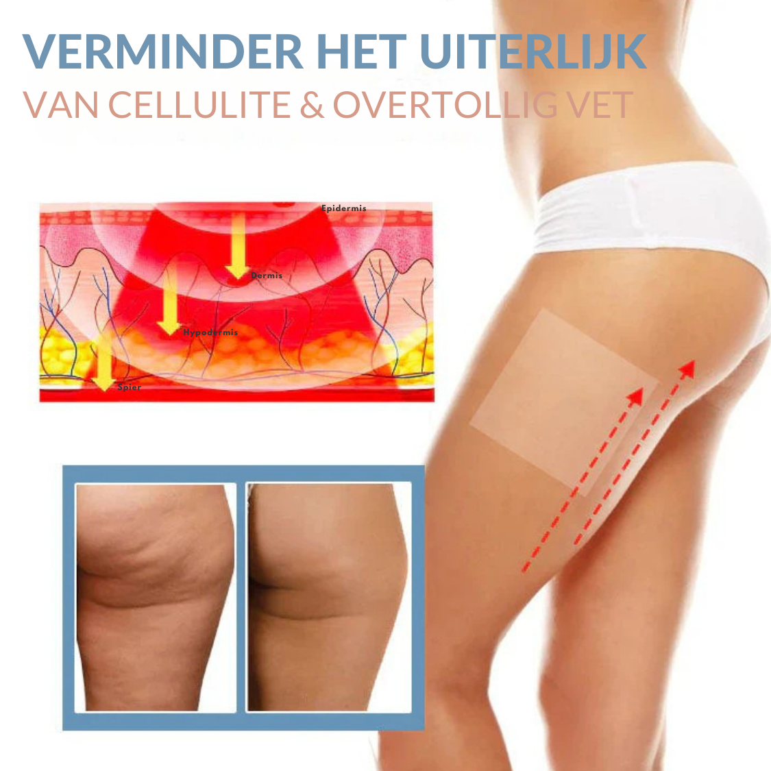 FirmiSkin™ | Anti-Cellulite Verstevigende Patches