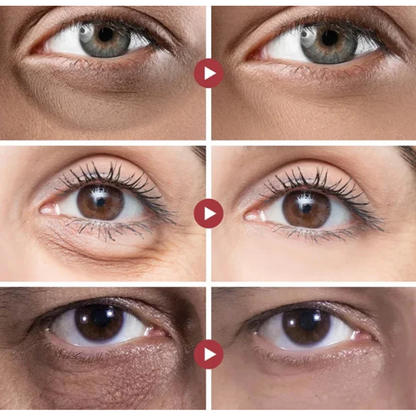 DewLisse™ | Collageen Oogcrème