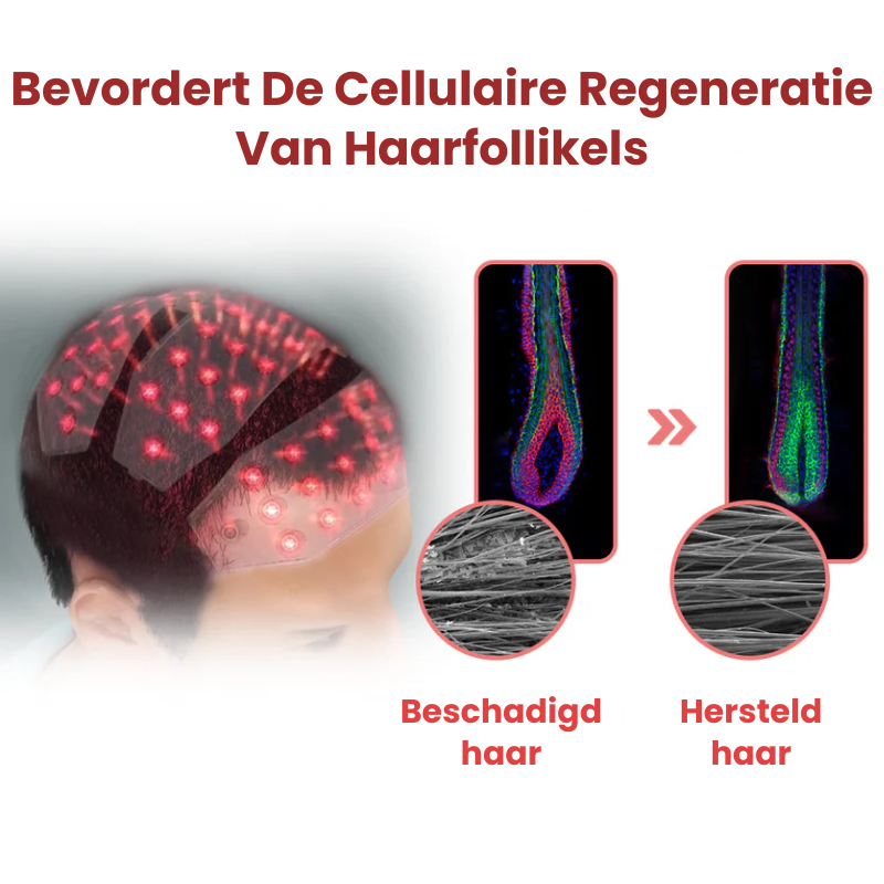 WarmtHaar™ | Infrarood Haartherapie Kap