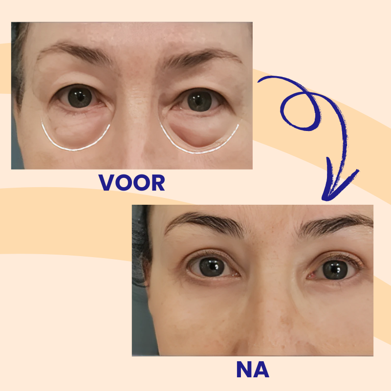 DewLisse™ | Collageen Oogcrème