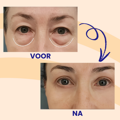 DewLisse™ | Collageen Oogcrème