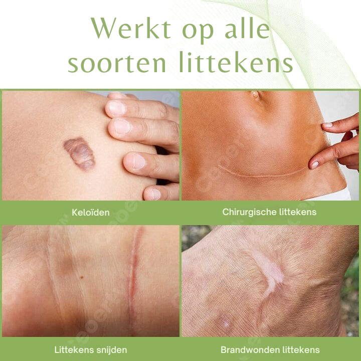 SkinRenew™ | Litteken Reparatie Serum