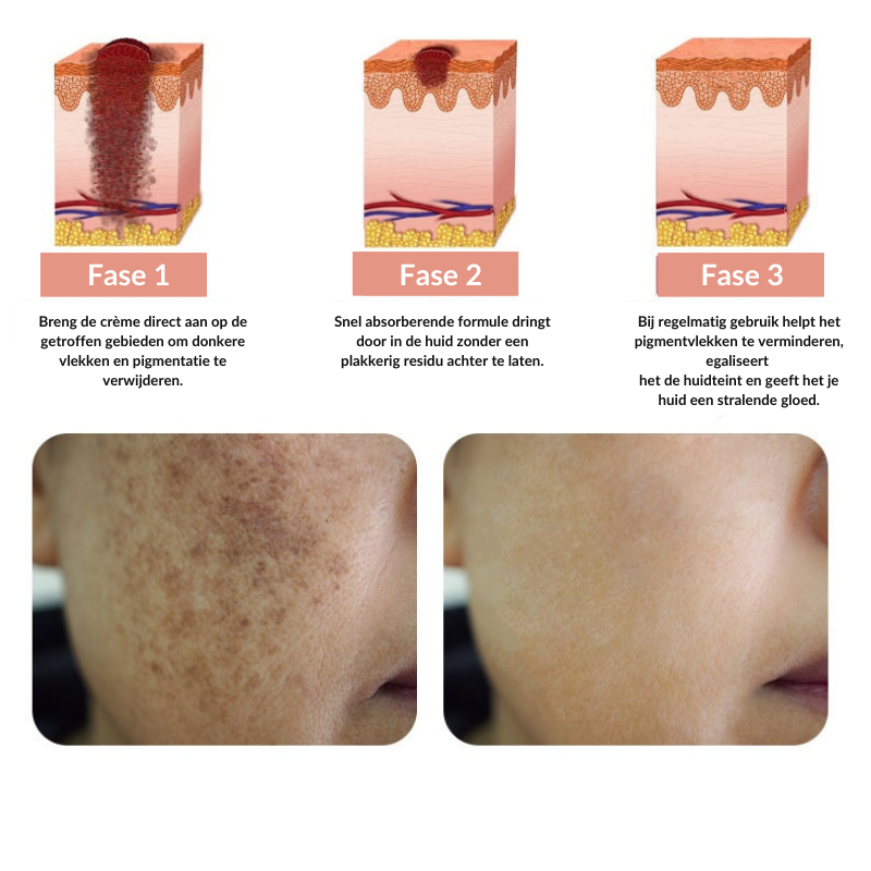 CollaFortify™ | Collageen Jelly Crème