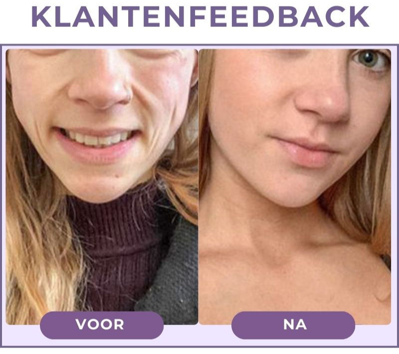 BLYSSÉVER™ | Anti-verouderingsserum