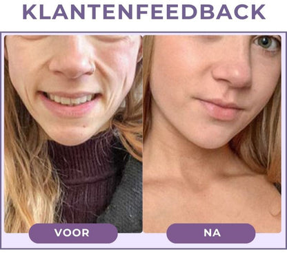 BLYSSÉVER™ | Anti-verouderingsserum