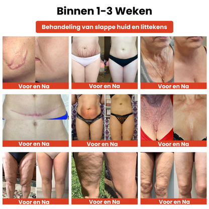 FirmEvoque™ | Verstevigende Lichaamsolie