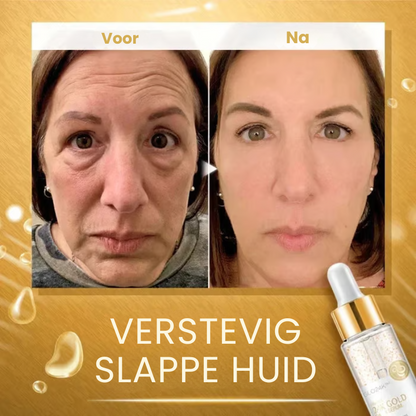 RejuviGold™ | Collageen Booster Serum