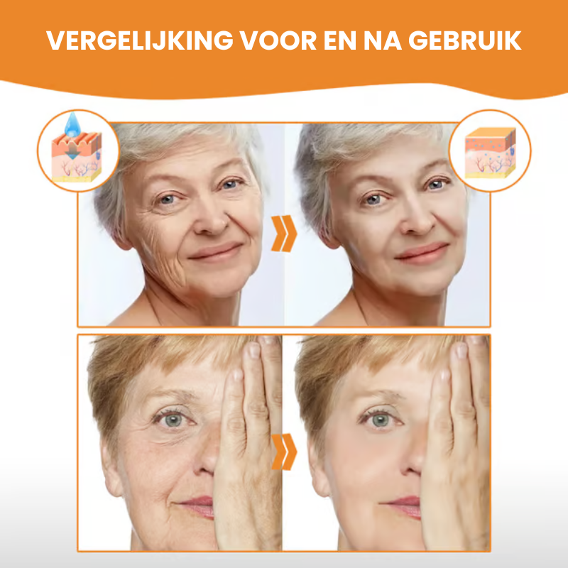 COLLSKISSEN™ | Collageen Huidessence Set