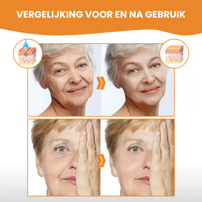 COLLSKISSEN™ | Collageen Huidessence Set