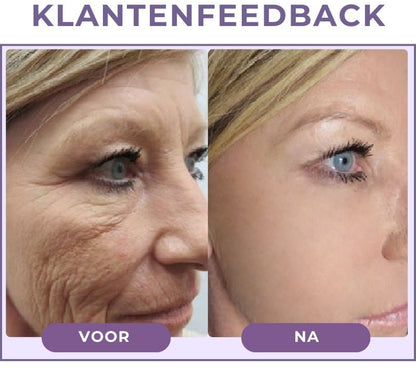 BLYSSÉVER™ | Anti-verouderingsserum