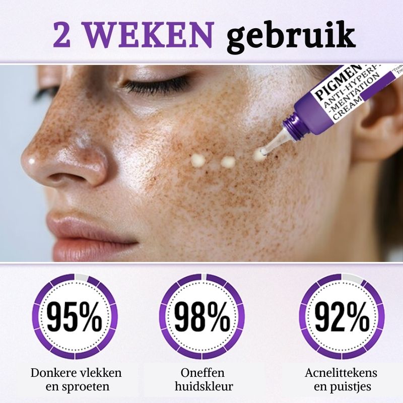 MistéqPigment™ | Anti-Hyperpigmentatiecrème