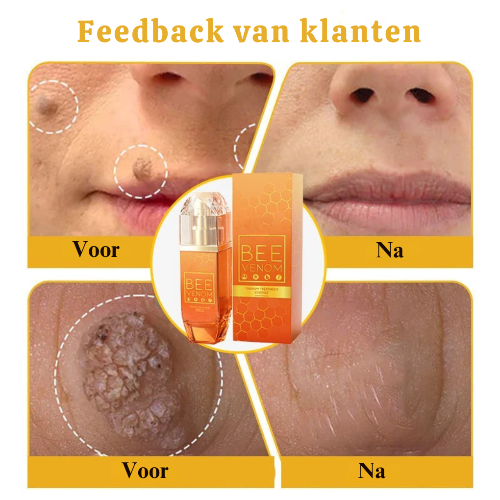 HIVECURA™ | Huidverzorgingsessence