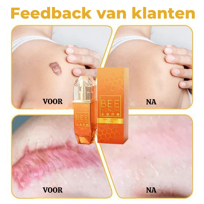 HIVECURA™ | Huidverzorgingsessence