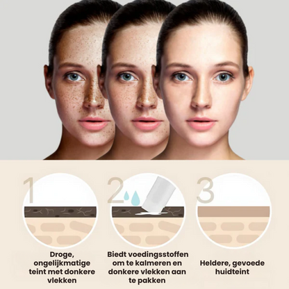 STIKLYRIVE™ | Verstevigende Stick