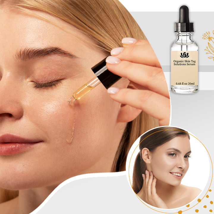 Spotless Skin™ | Biologisch Huidtagoplossingen Serum