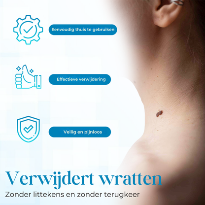 PapiClear™ | Huidtag & Wratten Crème