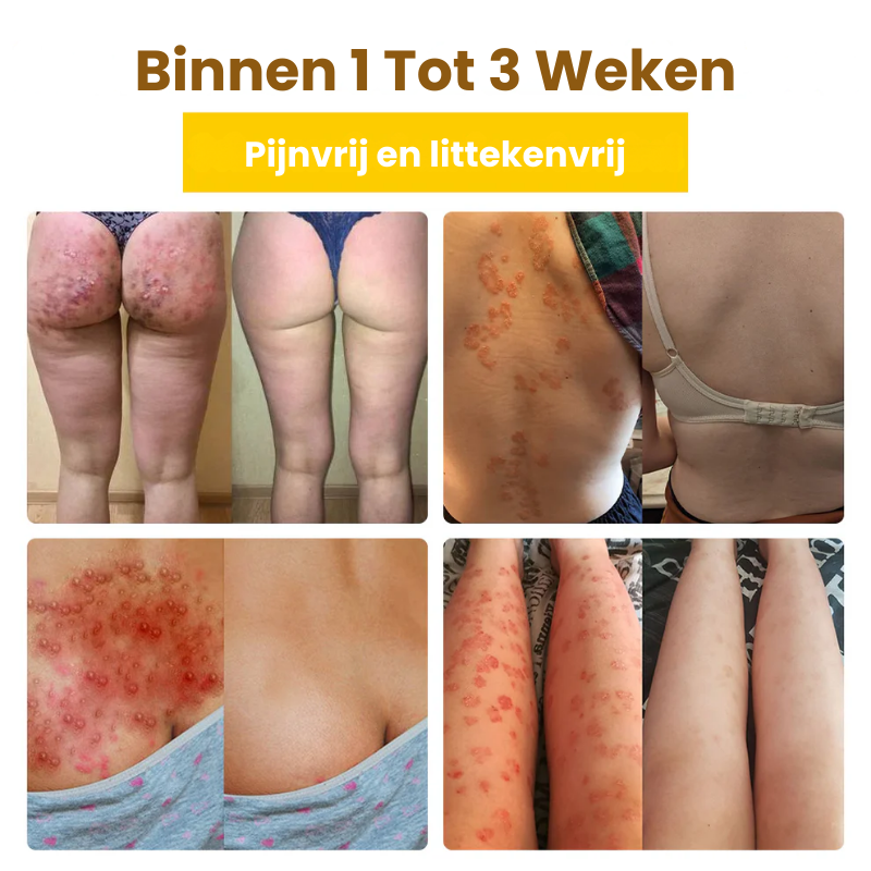 DermaZorg™ | Behandelingscrème