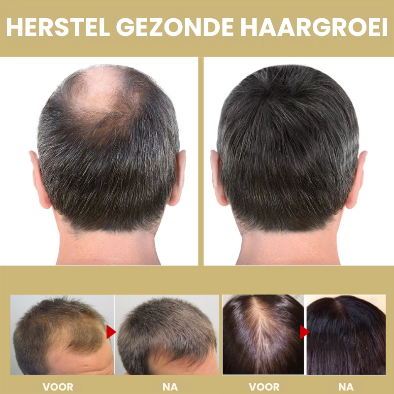 WarmtHaar™ | Infrarood Haartherapie Kap