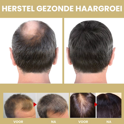 WarmtHaar™ | Infrarood Haartherapie Kap