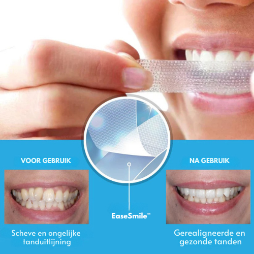 EaseSmile™ | Tanden Aligner Strips