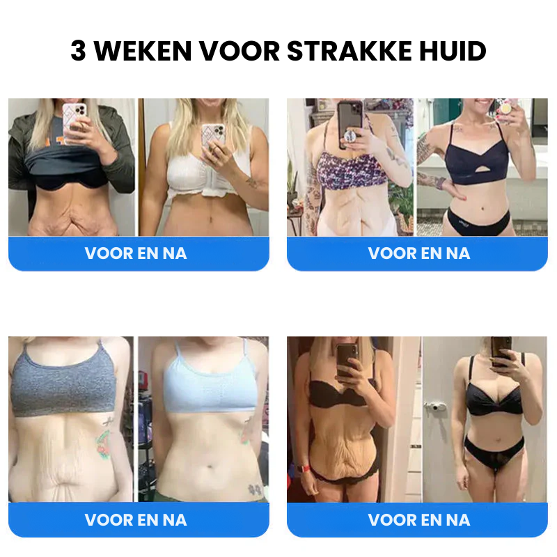 EMUSORA™ | Verstevigende en Anti-rimpel Crème