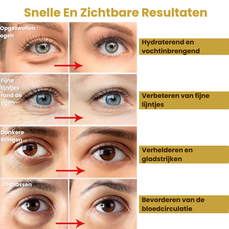 GoldWynk™ | Oogmasker