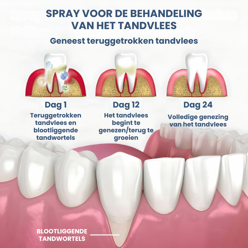 ORATALITY™ | Tandvleesherstel Spray
