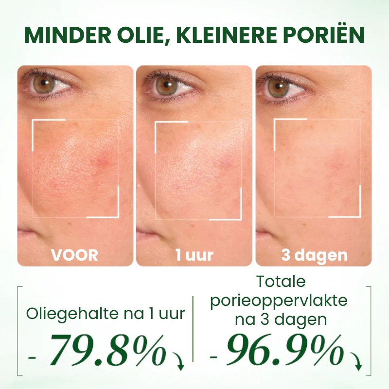 PORADICATE™ | Avocadozuurmasker