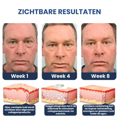 PUFFVISH™ | Ontzwellend Oogserum